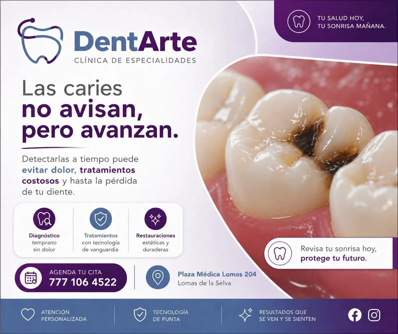Diagnóstico y tratamiento de caries